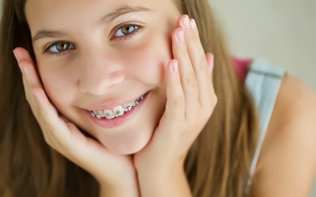 Why You Should Get Braces in the Summer